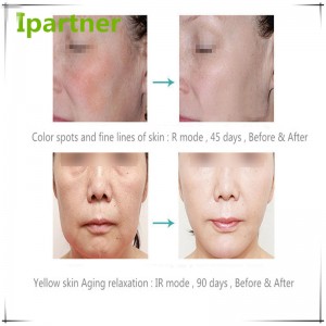 Équipement chaud de beauté de thérapie de photon de la vente LED pour des soins de la peau