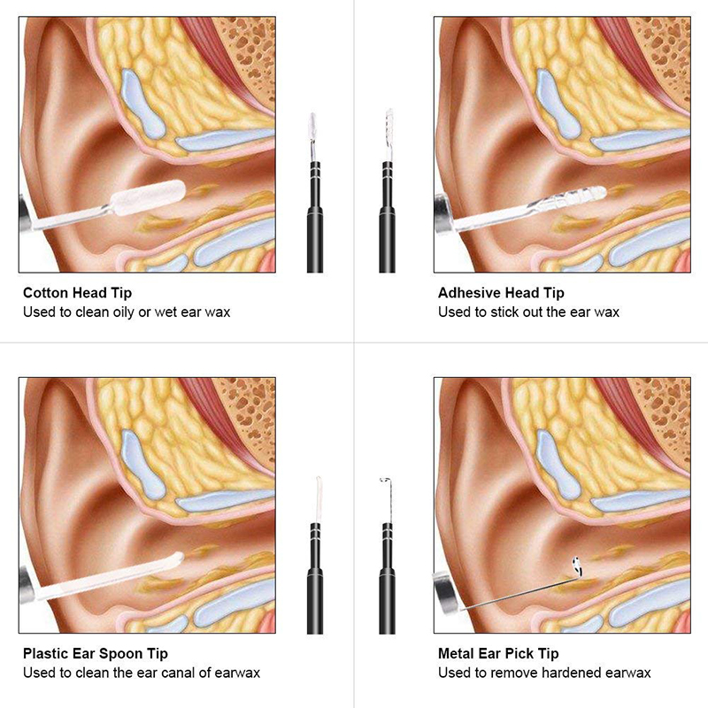 Wifi Otoscope 3 dans 1 oreille Remover outil 720P caméra étanche avec 6 LED réglables compatible avec Android et iOS