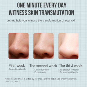 Extracteur électrique Détecteur d\'acné Remover Blackhead Aspirateur Beauté Machine Pore Cleaner