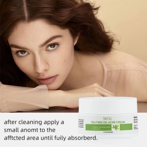 Crème à l\'acné d\'huile d\'arbre à thé