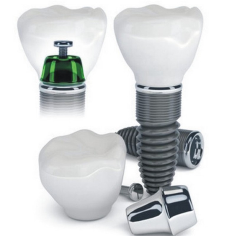 implant dentaire