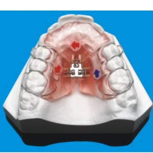 Série orthodontique